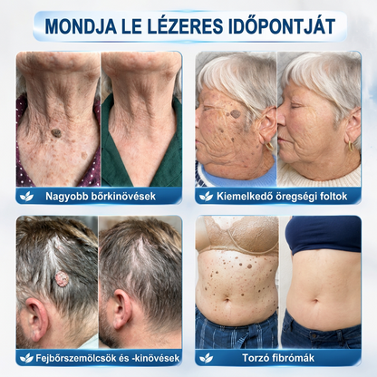 𝐏𝐮𝐫𝐚𝐂𝐮𝐫𝐞® 𝐌𝐈𝐊𝐑𝐎𝐓Ű𝐒 𝐁Ő𝐑𝐊𝐈𝐍Ö𝐕É𝐒-𝐄𝐋𝐓Á𝐕𝐎𝐋Í𝐓Ó 𝐓𝐀𝐏𝐀𝐒𝐙𝐎𝐊 —𝟕 𝐍𝐀𝐏𝐎𝐒 𝐂É𝐋𝐙𝐎𝐓𝐓 𝐄𝐋𝐓Á𝐕𝐎𝐋Í𝐓Á𝐒 𝐁Ő𝐑𝐍𝐘Ú𝐋𝐕Á𝐍𝐘𝐎𝐊, 𝐒𝐙𝐄𝐌Ö𝐋𝐂𝐒Ö𝐊 É𝐒 𝐊𝐈𝐄𝐌𝐄𝐋𝐊𝐄𝐃Ő 𝐁Ő𝐑𝐇𝐈𝐁Á𝐊 𝐄𝐋𝐋𝐄𝐍
