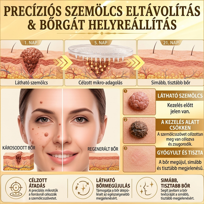 ✨PuraCure® TÖBBFÉLE BŐRPROBLÉMÁRA HATÓ MÉHMÉREG MIKROTŰS BŐRREGENERÁLÓ TAPASZOK