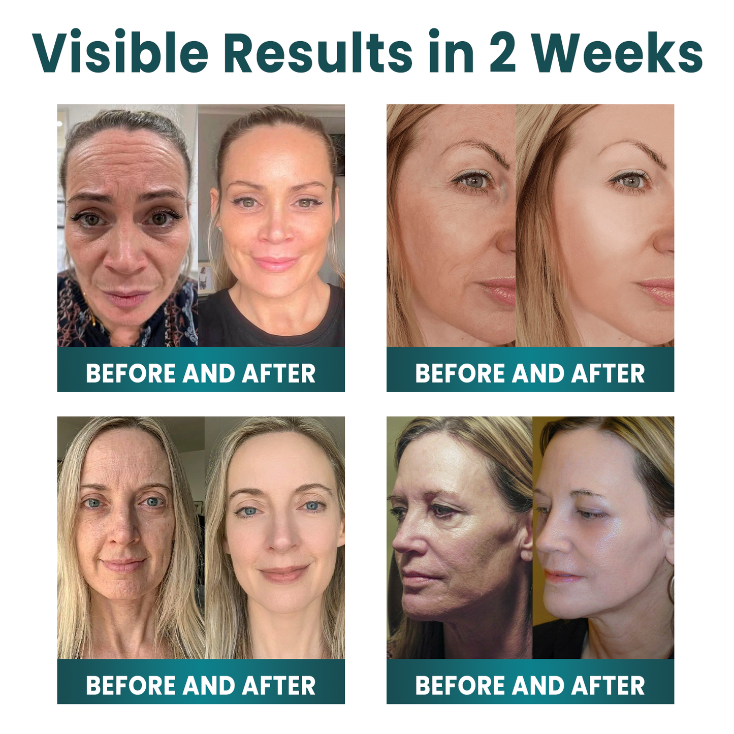 ✨ NORUION®  Q10 x Botanical Nano Exosome Advanced Anti-Wrinkle Cream