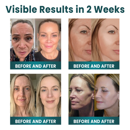 ✨ NORUION®  Q10 x Botanical Nano Exosome Advanced Anti-Wrinkle Cream