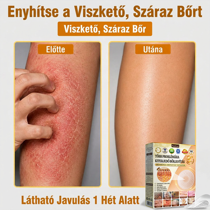 ✨PuraCure® TÖBBFÉLE BŐRPROBLÉMÁRA HATÓ MÉHMÉREG MIKROTŰS BŐRREGENERÁLÓ TAPASZOK