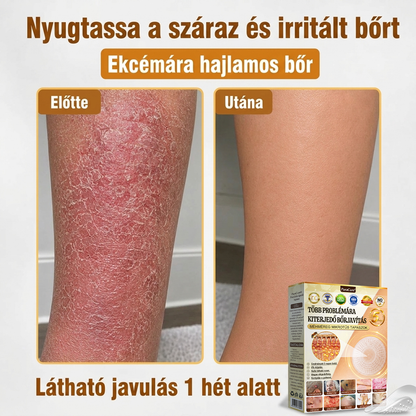 ✨PuraCure® TÖBBFÉLE BŐRPROBLÉMÁRA HATÓ MÉHMÉREG MIKROTŰS BŐRREGENERÁLÓ TAPASZOK