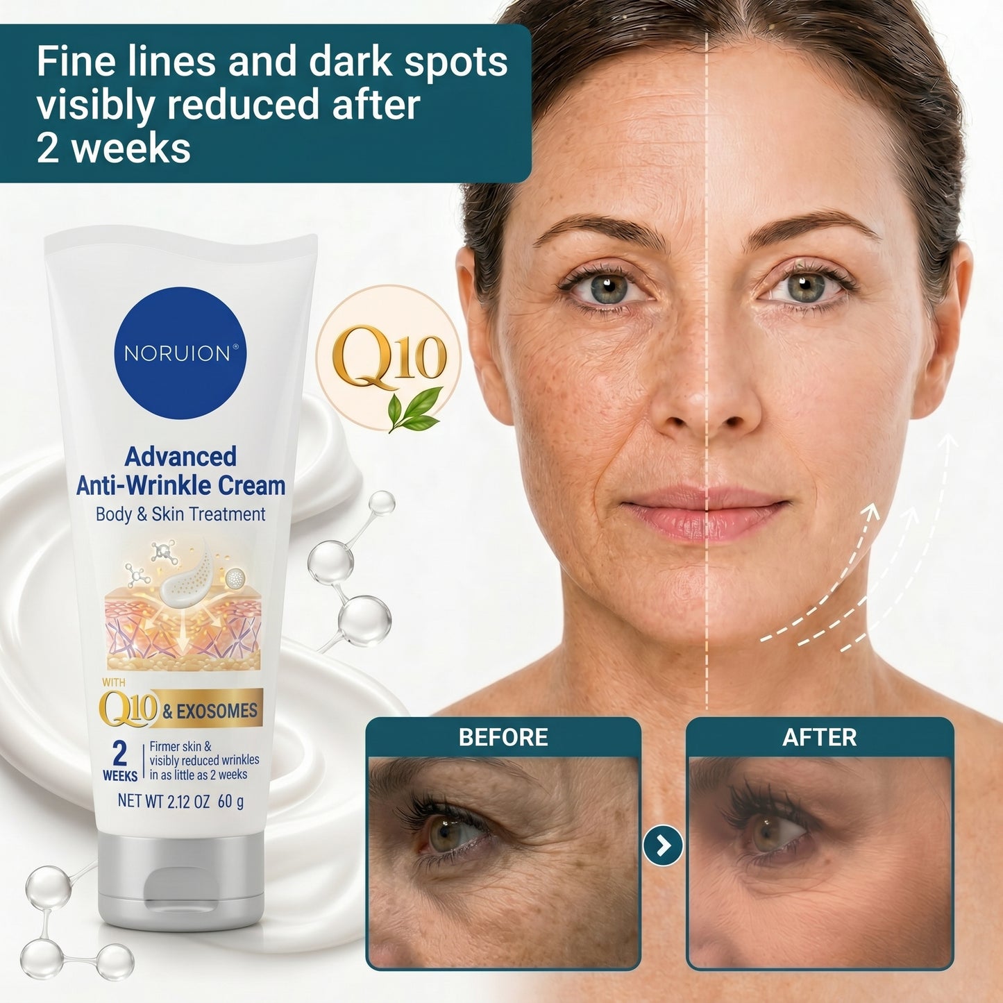 ✨ NORUION®  Q10 x Botanical Nano Exosome Advanced Anti-Wrinkle Cream
