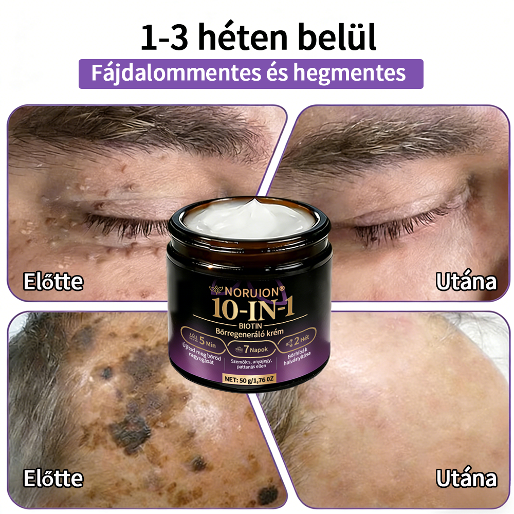 Magyarországról szállítva ✨ NORUION® Biotin 10 az 1-ben bőrmegújító krém