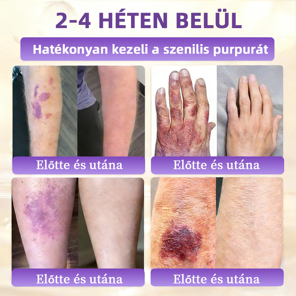 Magyarországról szállítva ✨ NORUION® Biotin 10 az 1-ben bőrmegújító krém
