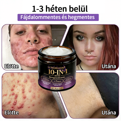 Magyarországról szállítva ✨ NORUION® Biotin 10 az 1-ben bőrmegújító krém