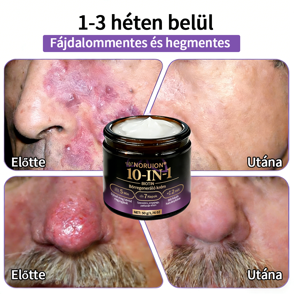 Magyarországról szállítva ✨ NORUION® Biotin 10 az 1-ben bőrmegújító krém