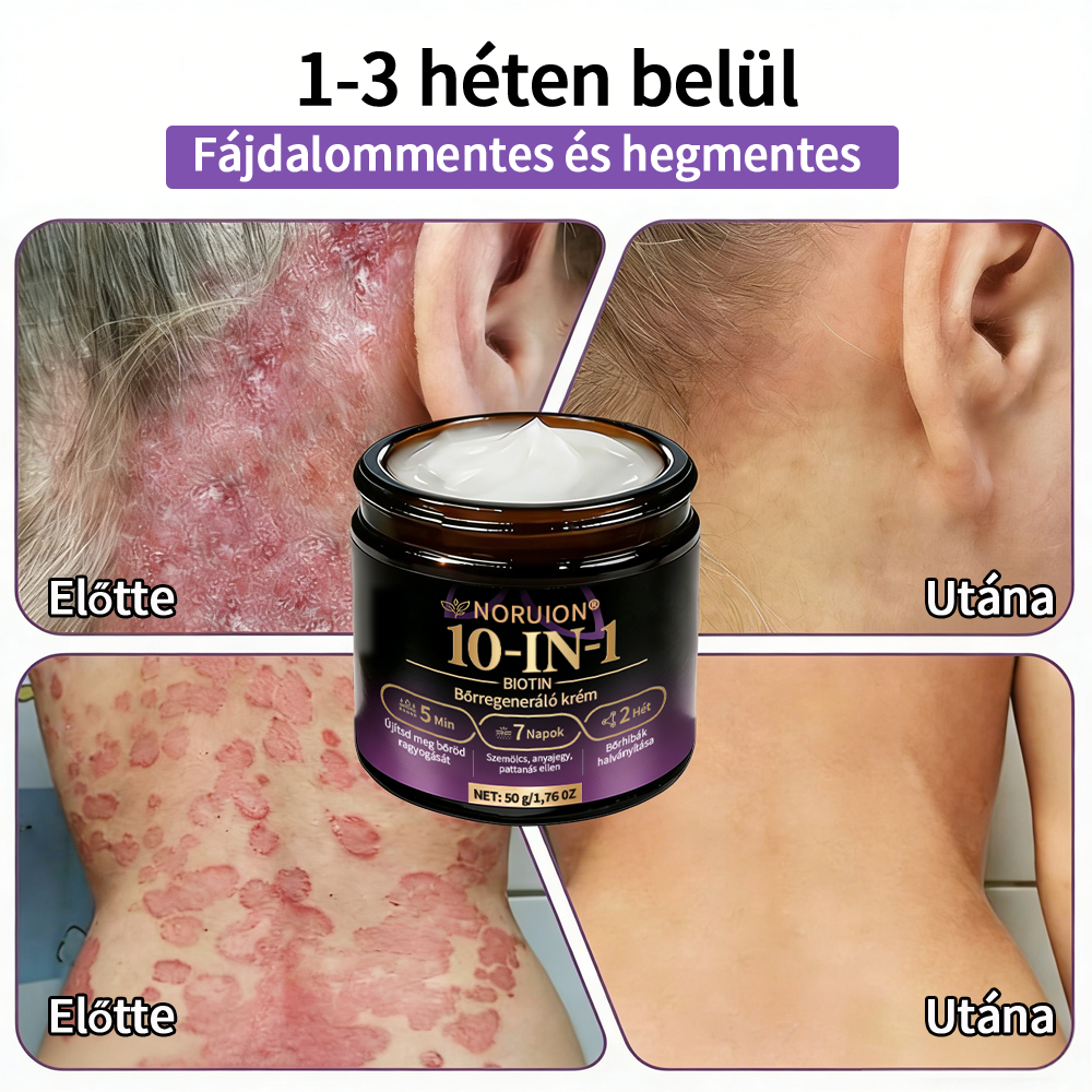 Magyarországról szállítva ✨ NORUION® Biotin 10 az 1-ben bőrmegújító krém