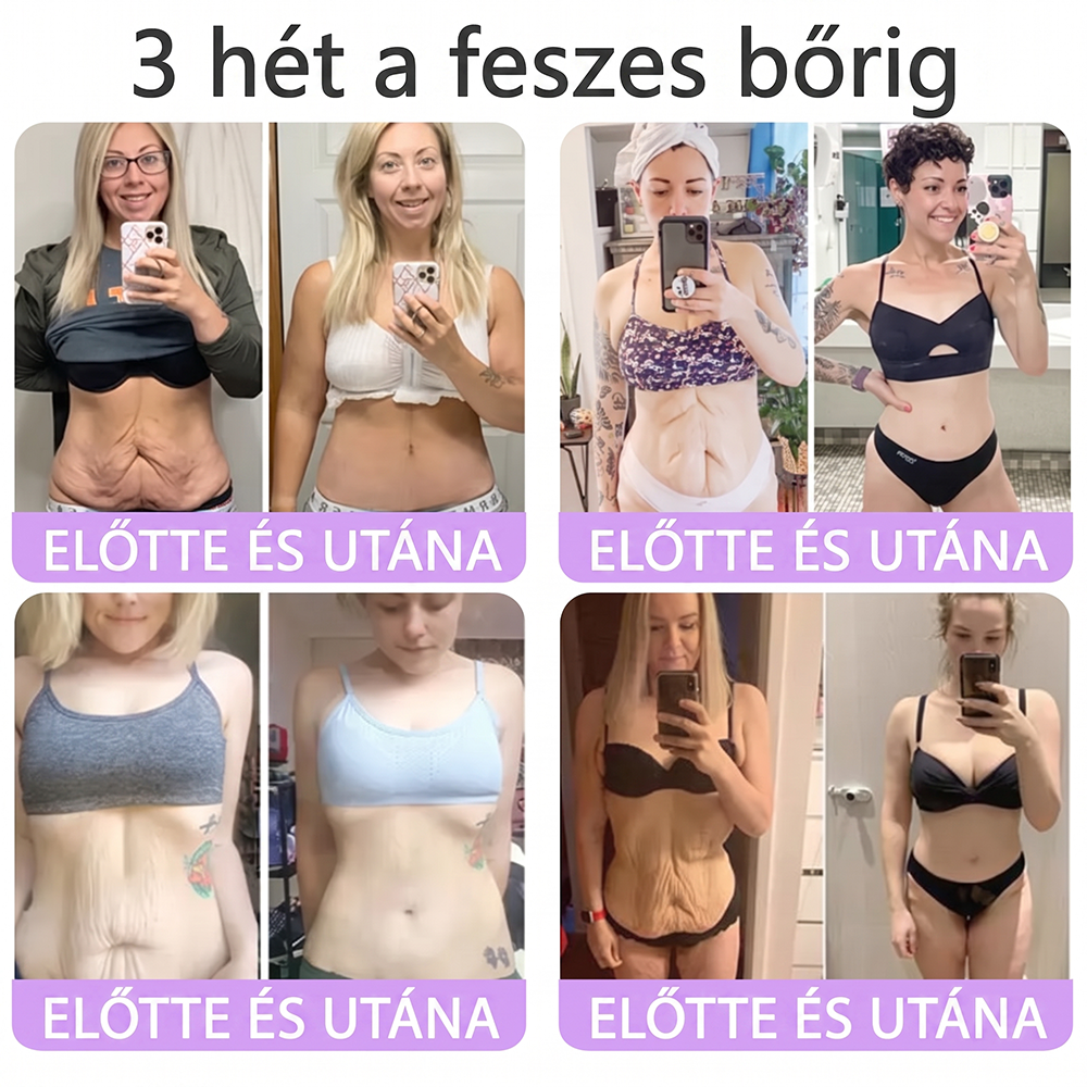 PuraCure® PDRN Multi-Peptid Masszírozó Testgörgős Krém – Öregedésgátlás, hidratálás, bőrfeszesítő és emelő hatás bőrjavítás, egyenletes bőrtónus, akne sötét foltok kezelése, szemölcsök és anyajegyek eltávolítása, valamint pikkelysömör enyhítése.