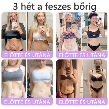 PuraCure® PDRN Multi-Peptid Masszírozó Testgörgős Krém – Öregedésgátlás, hidratálás, bőrfeszesítő és emelő hatás bőrjavítás, egyenletes bőrtónus, akne sötét foltok kezelése, szemölcsök és anyajegyek eltávolítása, valamint pikkelysömör enyhítése.