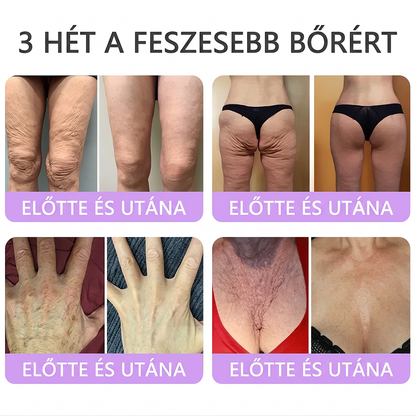 PuraCure® PDRN Multi-Peptid Masszírozó Testgörgős Krém – Öregedésgátlás, hidratálás, bőrfeszesítő és emelő hatás bőrjavítás, egyenletes bőrtónus, akne sötét foltok kezelése, szemölcsök és anyajegyek eltávolítása, valamint pikkelysömör enyhítése.