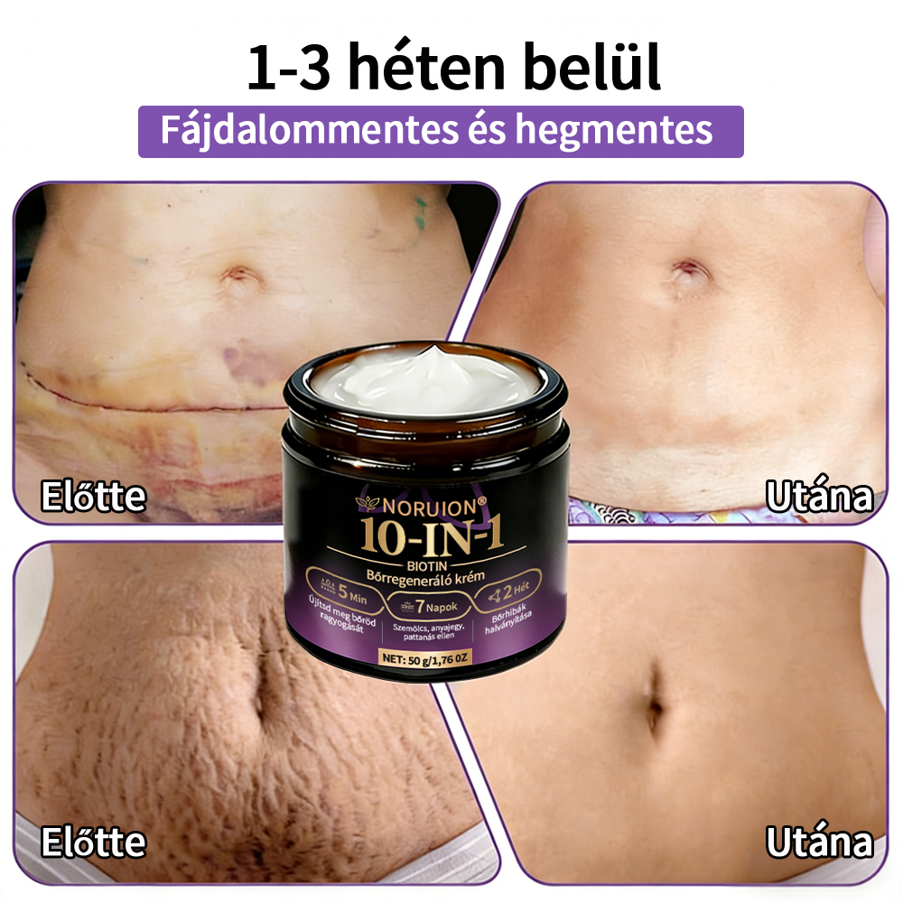 Magyarországról szállítva ✨ NORUION® Biotin 10 az 1-ben bőrmegújító krém