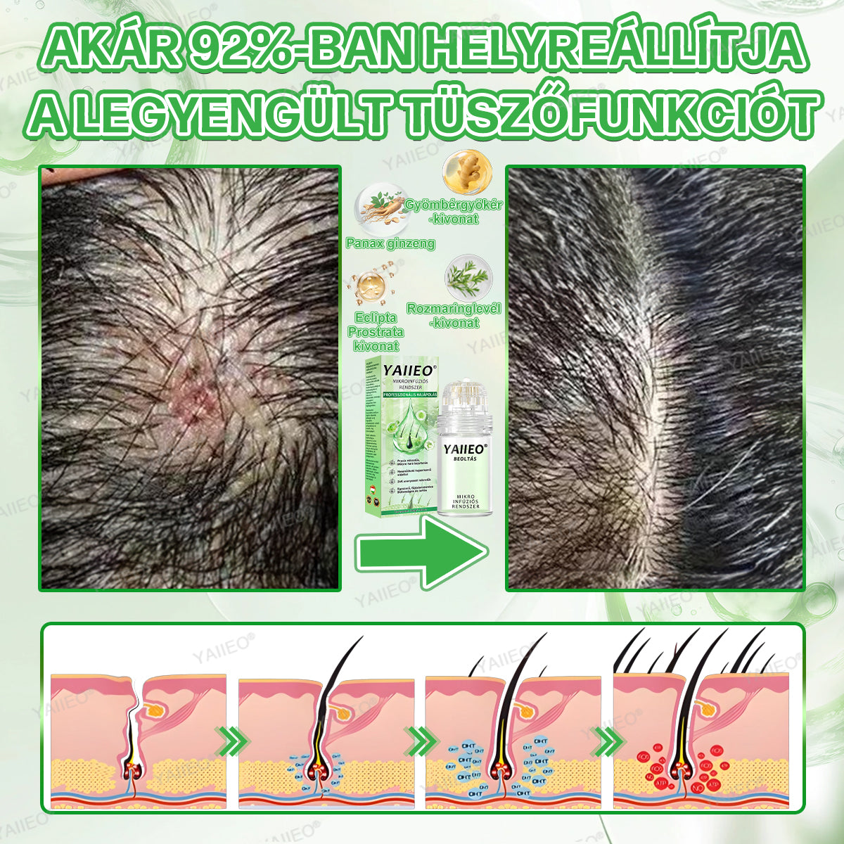 YAIIEO® 𝑭á𝒋𝒅𝒂𝒍𝒐𝒎𝒎𝒆𝒏𝒕𝒆𝒔 𝑴𝒊𝒌𝒓𝒐𝒊𝒏𝒇ú𝒛𝒊ó𝒔 𝑹𝒆𝒏𝒅𝒔𝒛𝒆𝒓