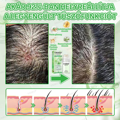 YAIIEO® 𝑭á𝒋𝒅𝒂𝒍𝒐𝒎𝒎𝒆𝒏𝒕𝒆𝒔 𝑴𝒊𝒌𝒓𝒐𝒊𝒏𝒇ú𝒛𝒊ó𝒔 𝑹𝒆𝒏𝒅𝒔𝒛𝒆𝒓