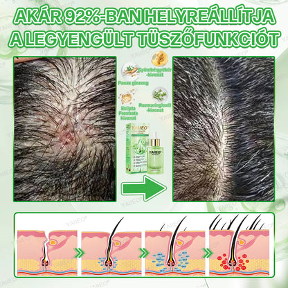 𝒀𝑨𝑰𝑰𝑬𝑶® 𝑯𝒂𝒋𝒔𝒆𝒓𝒌𝒆𝒏𝒕ő 𝑺𝒛é𝒓𝒖𝒎 – 𝑭á𝒋𝒅𝒂𝒍𝒐𝒎𝒎𝒆𝒏𝒕𝒆𝒔 𝑯𝒂𝒋á𝒑𝒐𝒍á𝒔