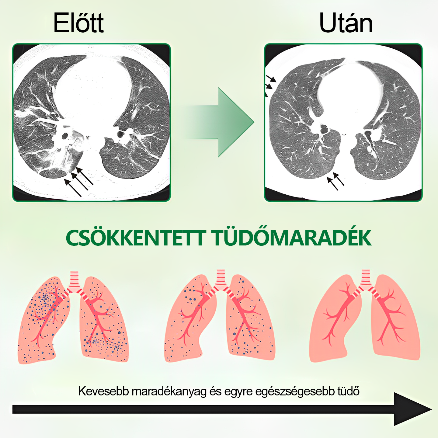 🍀BSWELL®  Fejlett Tüdőtisztító Spray -Támogatja a tüdő, a hörgők és az orrmelléküregek egészségét, elősegíti a légzőrendszer egészségét és a könnyebb légzést