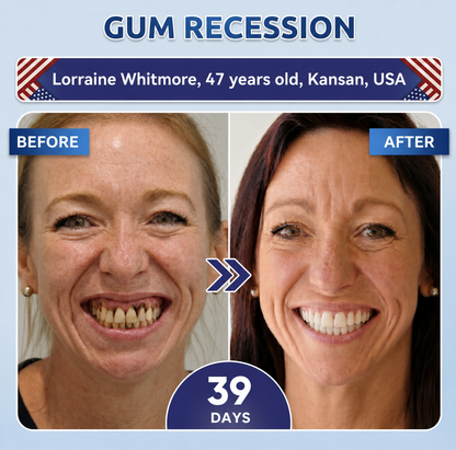 🦷PuraCure® Multi-Action Tooth & Gum Repair Mouthwash  | Collagen × Postbiotics × β-Glucanase