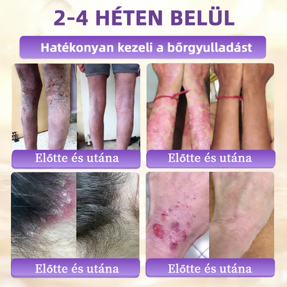 Magyarországról szállítva ✨ NORUION® Biotin 10 az 1-ben bőrmegújító krém