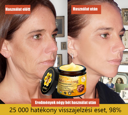 📦 Bőrgyógyász ajánlása ✨ ZödVita® Méhméreg Bőr Helyreállító Krém 🔥 Magyar fejlesztés, magyarországi gyártás és szállítás