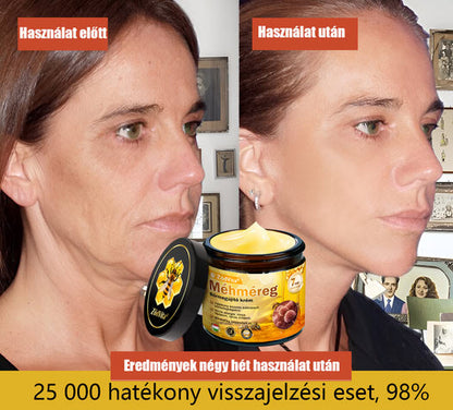 📦 Bőrgyógyász ajánlása ✨ ZödVita® Méhméreg Bőr Helyreállító Krém 🔥 Magyar fejlesztés, magyarországi gyártás és szállítás