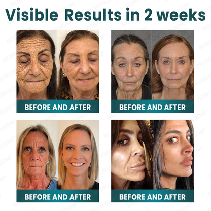 ✨ NORUION®  Q10 x Botanical Nano Exosome Advanced Anti-Wrinkle Cream