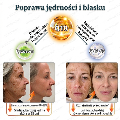 🔥 NORUION® Q10 x Roślinne Nano Egzosomy Zaawansowany krem przeciwzmarszczkowy