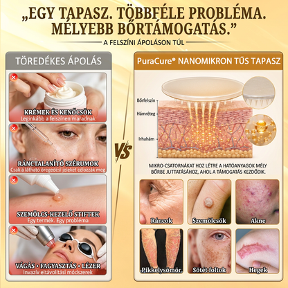 ✨PuraCure® TÖBBFÉLE BŐRPROBLÉMÁRA HATÓ MÉHMÉREG MIKROTŰS BŐRREGENERÁLÓ TAPASZOK