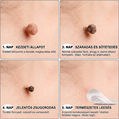 𝐏𝐮𝐫𝐚𝐂𝐮𝐫𝐞® 𝐌𝐈𝐊𝐑𝐎𝐓Ű𝐒 𝐁Ő𝐑𝐊𝐈𝐍Ö𝐕É𝐒-𝐄𝐋𝐓Á𝐕𝐎𝐋Í𝐓Ó 𝐓𝐀𝐏𝐀𝐒𝐙𝐎𝐊 —𝟕 𝐍𝐀𝐏𝐎𝐒 𝐂É𝐋𝐙𝐎𝐓𝐓 𝐄𝐋𝐓Á𝐕𝐎𝐋Í𝐓Á𝐒 𝐁Ő𝐑𝐍𝐘Ú𝐋𝐕Á𝐍𝐘𝐎𝐊, 𝐒𝐙𝐄𝐌Ö𝐋𝐂𝐒Ö𝐊 É𝐒 𝐊𝐈𝐄𝐌𝐄𝐋𝐊𝐄𝐃Ő 𝐁Ő𝐑𝐇𝐈𝐁Á𝐊 𝐄𝐋𝐋𝐄𝐍