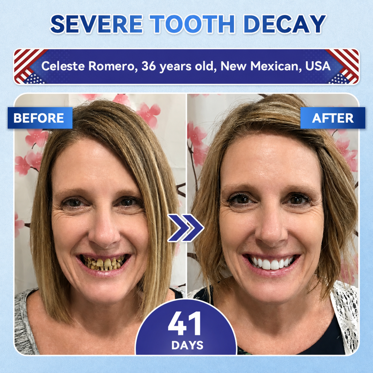 🦷PuraCure® Multi-Action Tooth & Gum Repair Mouthwash  | Collagen × Postbiotics × β-Glucanase