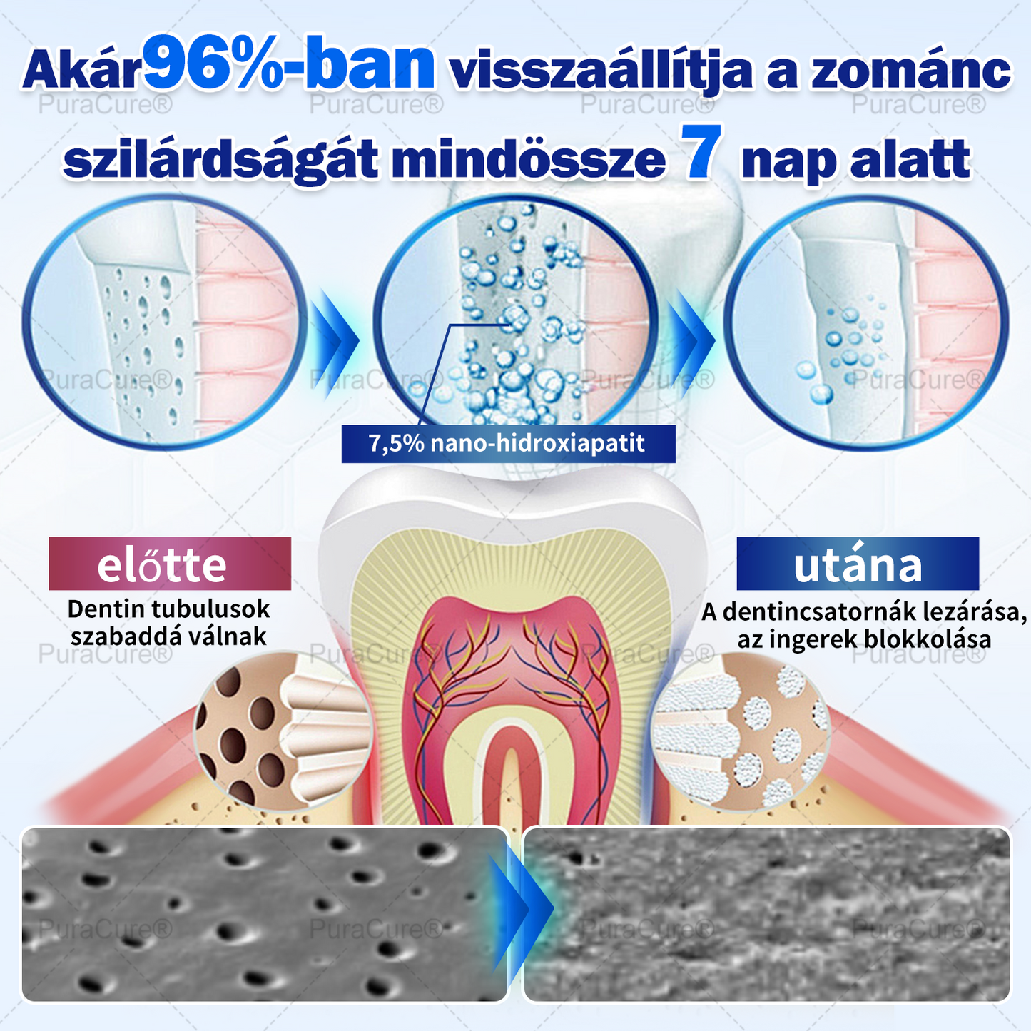 7,5% Nano-Hidroxiapatit Zománcjavító Fogkrém – Fluoridmentes Remineralizáló Formula, Csökkenti a Fogérzékenységet, Segít Megelőzni a Fogszuvasodást, 16 Órás Friss Lehelet – Minden Korosztály Számára