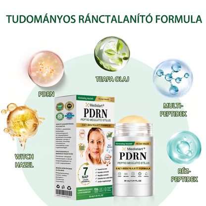 𝐌𝐞𝐝𝐢𝐬𝐭𝐚𝐫𝐭® ☘️☘️ 𝐏𝐃𝐑𝐍 Ö𝐫𝐞𝐠𝐞𝐝é𝐬𝐠á𝐭𝐥ó & 𝐂é𝐥𝐳𝐨𝐭𝐭 𝐅𝐨𝐥𝐭𝐦𝐞𝐠ú𝐣í𝐭ó 𝐒𝐭𝐢𝐟𝐭  （𝐒𝐞𝐠í𝐭 𝐤𝐢𝐬𝐢𝐦í𝐭𝐚𝐧𝐢 𝐚 𝐫á𝐧𝐜𝐨𝐤 𝐦𝐞𝐠𝐣𝐞𝐥𝐞𝐧é𝐬é𝐭, 𝐭á𝐦𝐨𝐠𝐚𝐭𝐣𝐚 𝐚 𝐟𝐞𝐬𝐳𝐞𝐬𝐞𝐛𝐛 𝐤𝐢𝐧é𝐳𝐞𝐭ű 𝐛ő𝐫𝐭, é𝐬 𝐣𝐚𝐯í𝐭𝐣𝐚 𝐚 𝐥á𝐭𝐡𝐚𝐭ó 𝐟𝐨𝐥𝐭𝐨𝐤 𝐦𝐞𝐠𝐣𝐞𝐥𝐞𝐧é𝐬é𝐭）