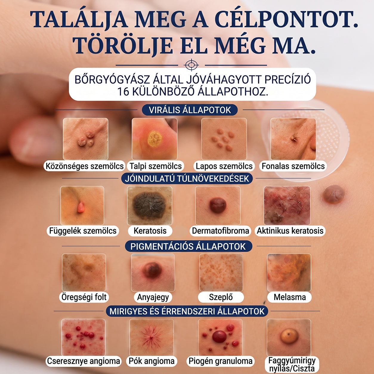 𝐏𝐮𝐫𝐚𝐂𝐮𝐫𝐞® 𝐌𝐈𝐊𝐑𝐎𝐓Ű𝐒 𝐁Ő𝐑𝐊𝐈𝐍Ö𝐕É𝐒-𝐄𝐋𝐓Á𝐕𝐎𝐋Í𝐓Ó 𝐓𝐀𝐏𝐀𝐒𝐙𝐎𝐊 —𝟕 𝐍𝐀𝐏𝐎𝐒 𝐂É𝐋𝐙𝐎𝐓𝐓 𝐄𝐋𝐓Á𝐕𝐎𝐋Í𝐓Á𝐒 𝐁Ő𝐑𝐍𝐘Ú𝐋𝐕Á𝐍𝐘𝐎𝐊, 𝐒𝐙𝐄𝐌Ö𝐋𝐂𝐒Ö𝐊 É𝐒 𝐊𝐈𝐄𝐌𝐄𝐋𝐊𝐄𝐃Ő 𝐁Ő𝐑𝐇𝐈𝐁Á𝐊 𝐄𝐋𝐋𝐄𝐍