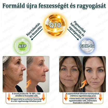 ✨ NORUION® Q10 + növényi nano-exoszóma fejlett ránctalanító krém