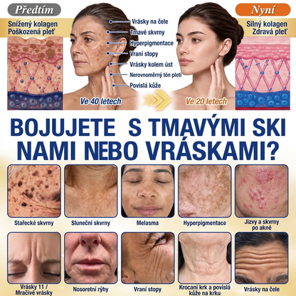 𝑶𝒇𝒊𝒄𝒊𝒂́𝒍𝒏𝒊́ 𝑶𝒃𝒄𝒉𝒐𝒅 | 𝐍𝐨𝐯𝐢𝐧𝐤𝐚! ✨ Medistart® 𝐊𝐮𝐫𝐤𝐮𝐦𝐚 × 𝐊𝐲𝐬𝐞𝐥𝐢𝐧𝐚 𝐤𝐨𝐣𝐨𝐯𝐚́ 𝐍𝐨𝐜̌𝐧𝐢́ 𝐨𝐦𝐥𝐚𝐳𝐮𝐣𝐢́𝐜𝐢́ 𝐤𝐫𝐞́𝐦 — 𝐙𝐞𝐬𝐯𝐞̌𝐭𝐥𝐢 𝐨𝐝𝐨𝐥𝐧𝐞́ 𝐭𝐦𝐚𝐯𝐞́ 𝐬𝐤𝐯𝐫𝐧𝐲 𝐚 𝐯𝐲𝐡𝐥𝐚𝐝̌ 𝐯𝐢𝐝𝐢𝐭𝐞𝐥𝐧𝐞́ 𝐯𝐫𝐚́𝐬𝐤𝐲 𝐛𝐞̌𝐡𝐞𝐦 𝐬𝐩𝐚́𝐧𝐤𝐮 🌙 ✅ 𝐉𝐞𝐝𝐞𝐧 𝐤𝐫𝐨𝐤 𝐤𝐚𝐳̌𝐝𝐨𝐮 𝐧𝐨𝐜 · 𝐕𝐢𝐝𝐢𝐭𝐞𝐥𝐧𝐚́ 𝐳𝐦𝐞̌𝐧𝐚 𝐳𝐚 𝟕 𝐧𝐨𝐜𝐢́ 💯