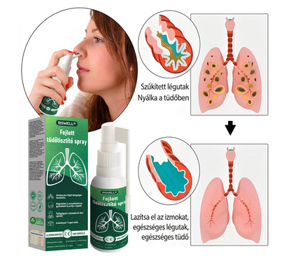 🍀BSWELL®  Fejlett Tüdőtisztító Spray -Támogatja a tüdő, a hörgők és az orrmelléküregek egészségét, elősegíti a légzőrendszer egészségét és a könnyebb légzést