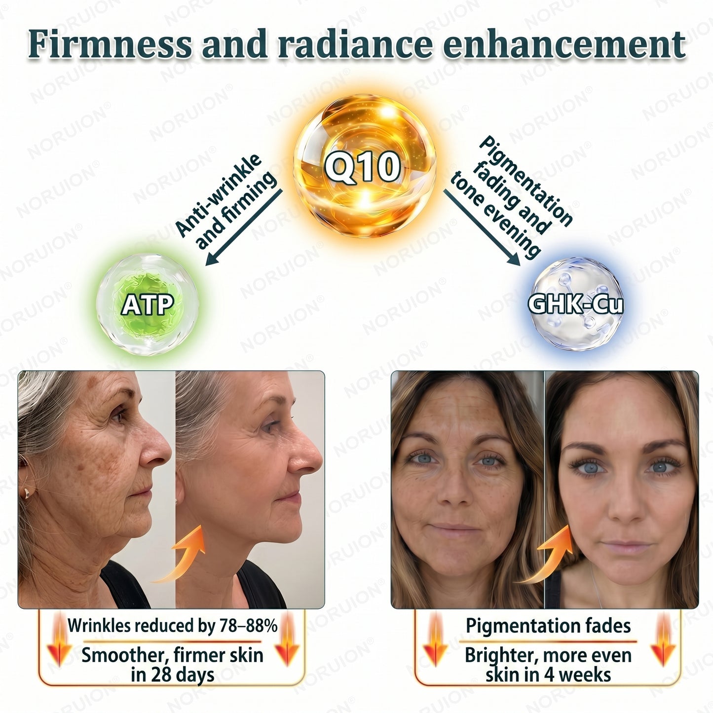 ✨ NORUION®  Q10 x Botanical Nano Exosome Advanced Anti-Wrinkle Cream