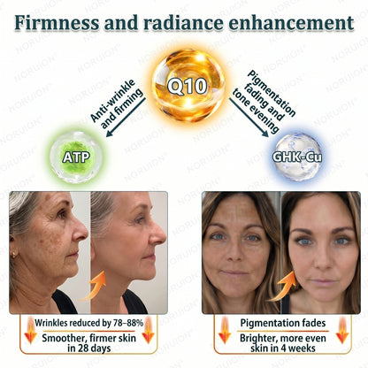 ✨ NORUION®  Q10 x Botanical Nano Exosome Advanced Anti-Wrinkle Cream
