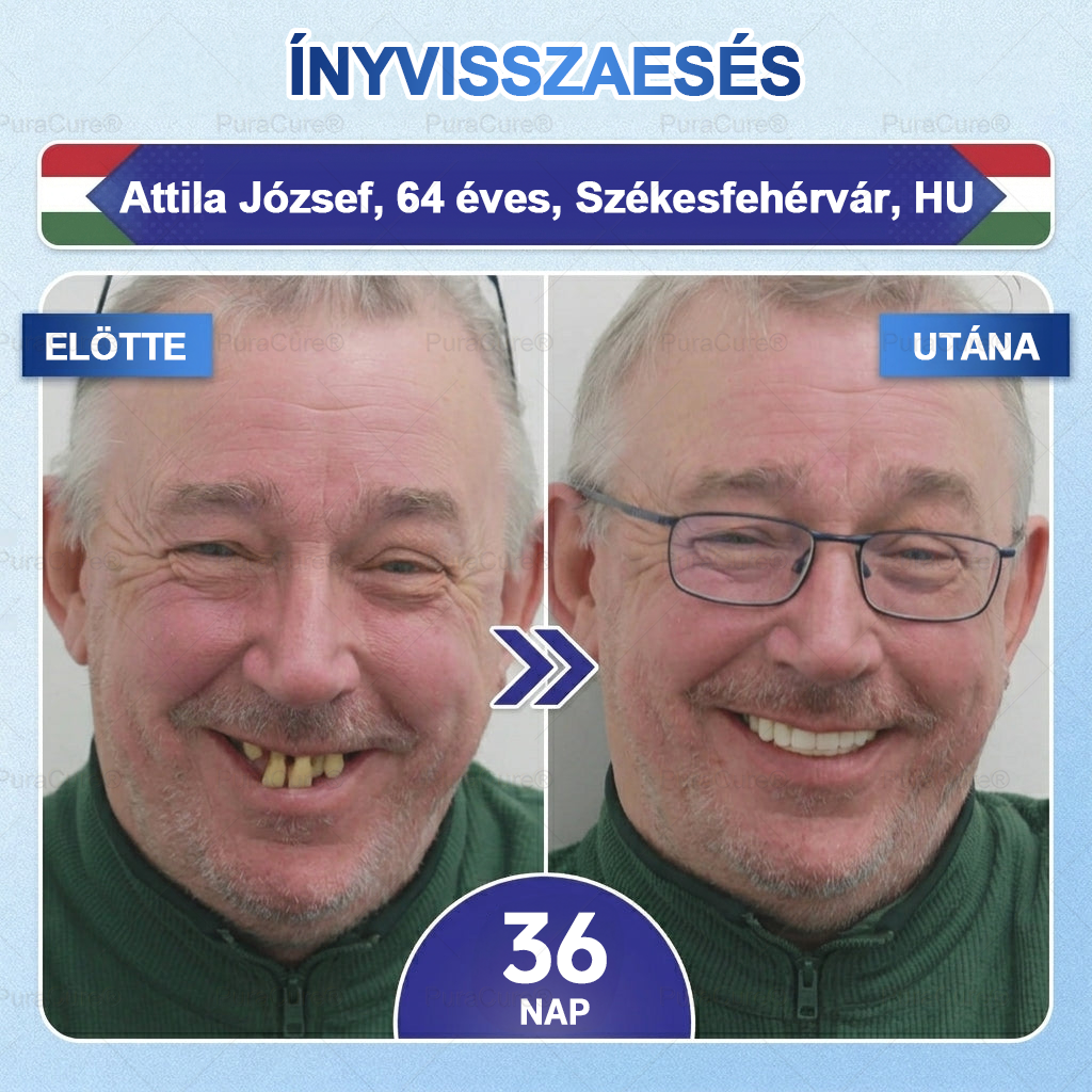 🦷PuraCure® többhatású fog- és ínyregeneráló szájvíz | Kollagén × posztbiotikumok × β-glükanáz