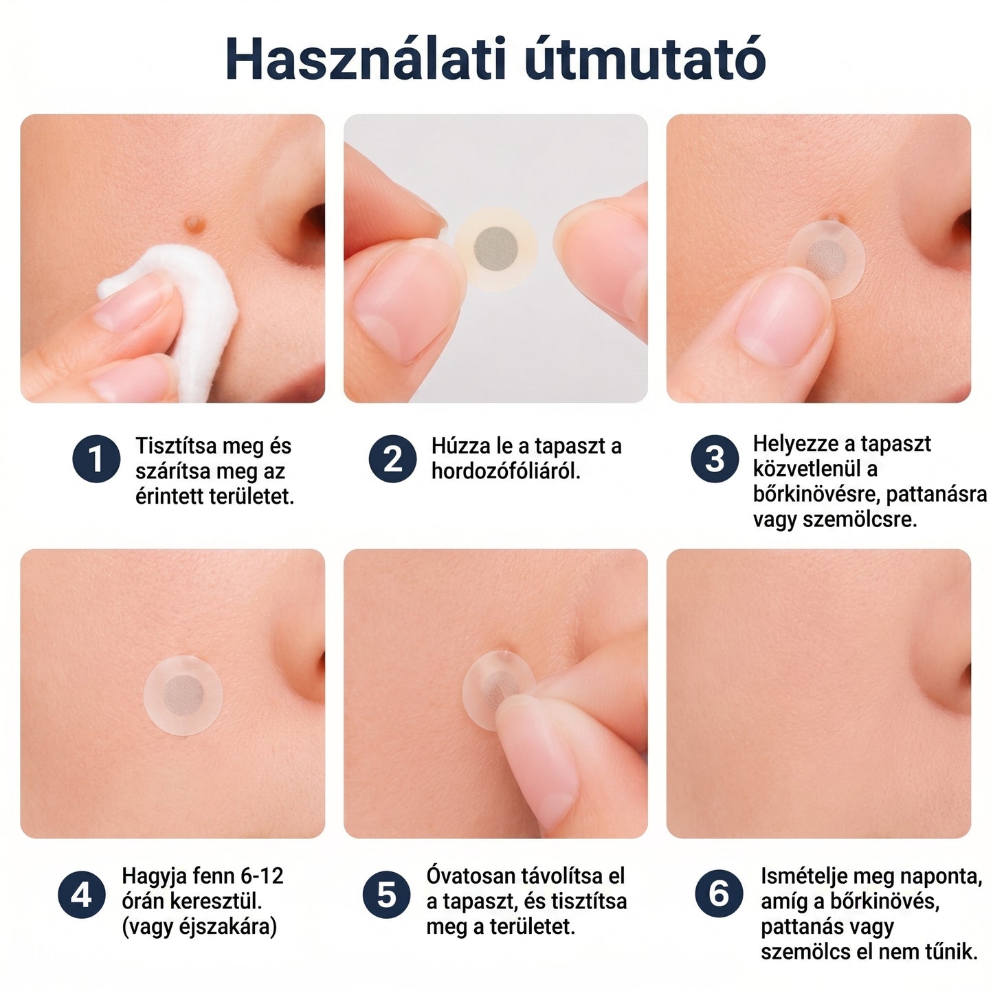 ✨ 2 az 1-ben mikrotűs és hidrokolloid tapasz🍀 | Kiálló anyajegyek, aknék, lapos szemölcsök és bőrnövedékek eltávolítására | Segít csökkenteni a ráncokat, hegeket és bőrhibákat | Láthatatlan tapasz az arcra és testre