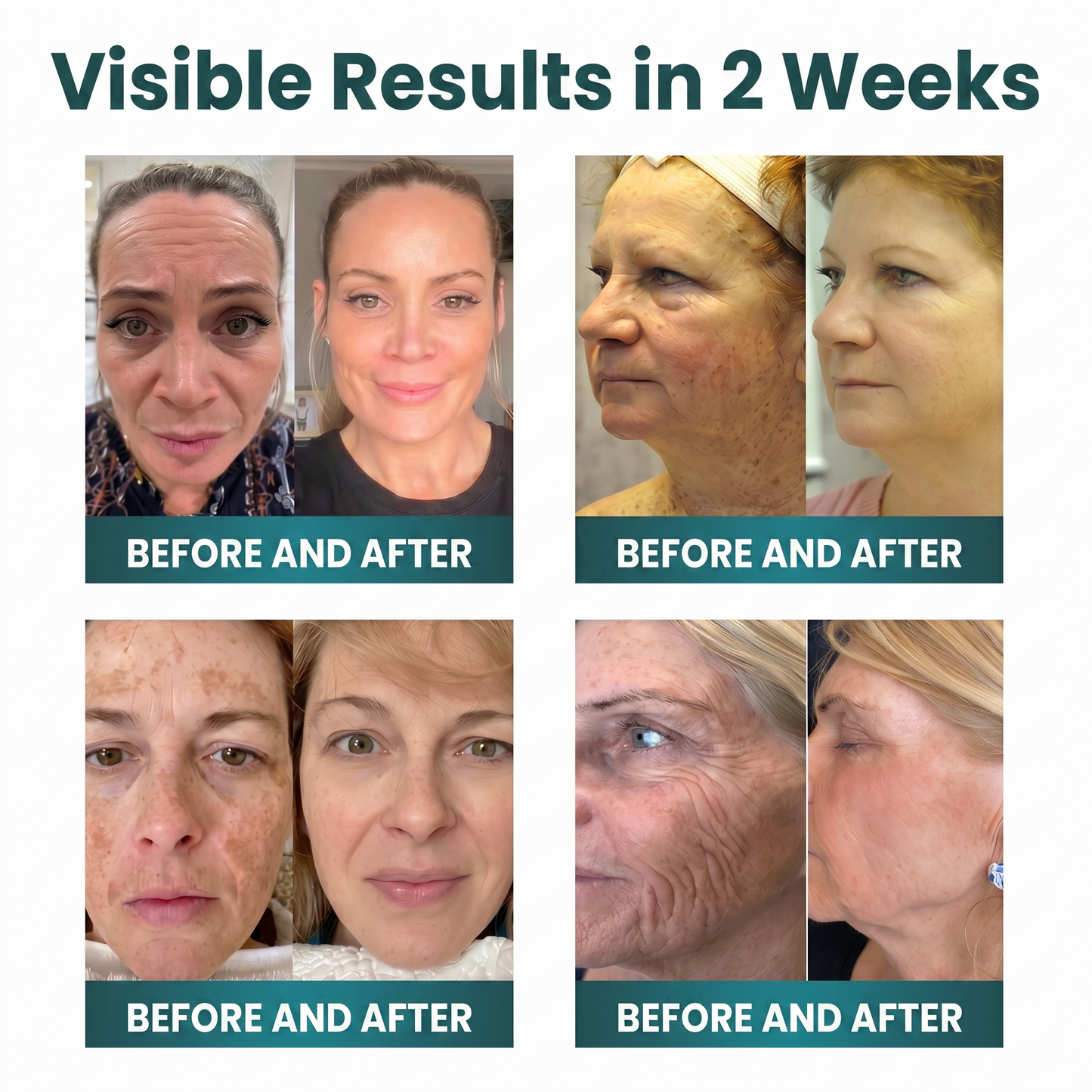 ✨ NORUION®  Q10 x Botanical Nano Exosome Advanced Anti-Wrinkle Cream