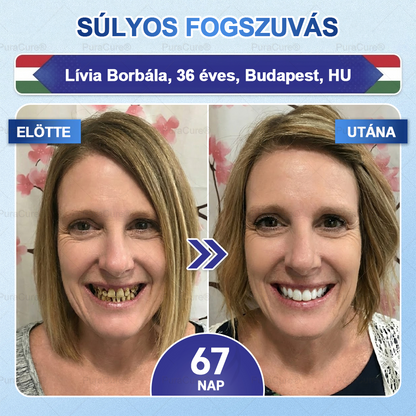 🦷PuraCure® többhatású fog- és ínyregeneráló szájvíz | Kollagén × posztbiotikumok × β-glükanáz
