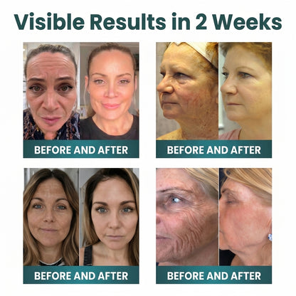 ✨ NORUION®  Q10 x Botanical Nano Exosome Advanced Anti-Wrinkle Cream
