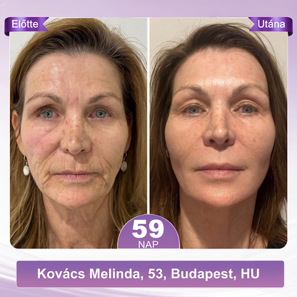 PuraCure® PDRN Multi-Peptid Masszírozó Testgörgős Krém – Öregedésgátlás, hidratálás, bőrfeszesítő és emelő hatás bőrjavítás, egyenletes bőrtónus, akne sötét foltok kezelése, szemölcsök és anyajegyek eltávolítása, valamint pikkelysömör enyhítése.