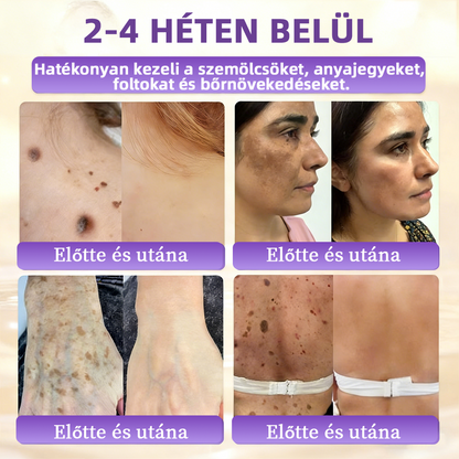 Magyarországról szállítva ✨ NORUION® Biotin 10 az 1-ben bőrmegújító krém