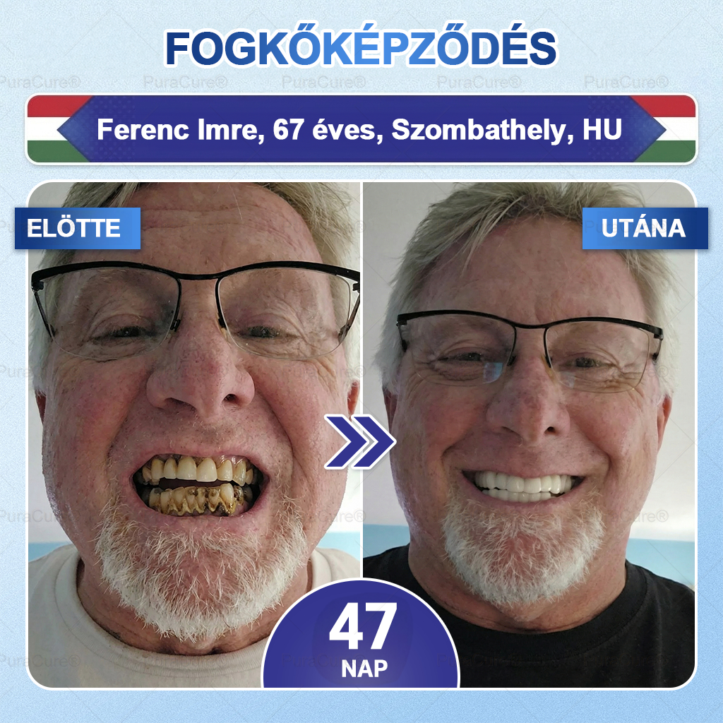 🦷PuraCure® többhatású fog- és ínyregeneráló szájvíz | Kollagén × posztbiotikumok × β-glükanáz