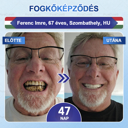 🦷PuraCure® többhatású fog- és ínyregeneráló szájvíz | Kollagén × posztbiotikumok × β-glükanáz