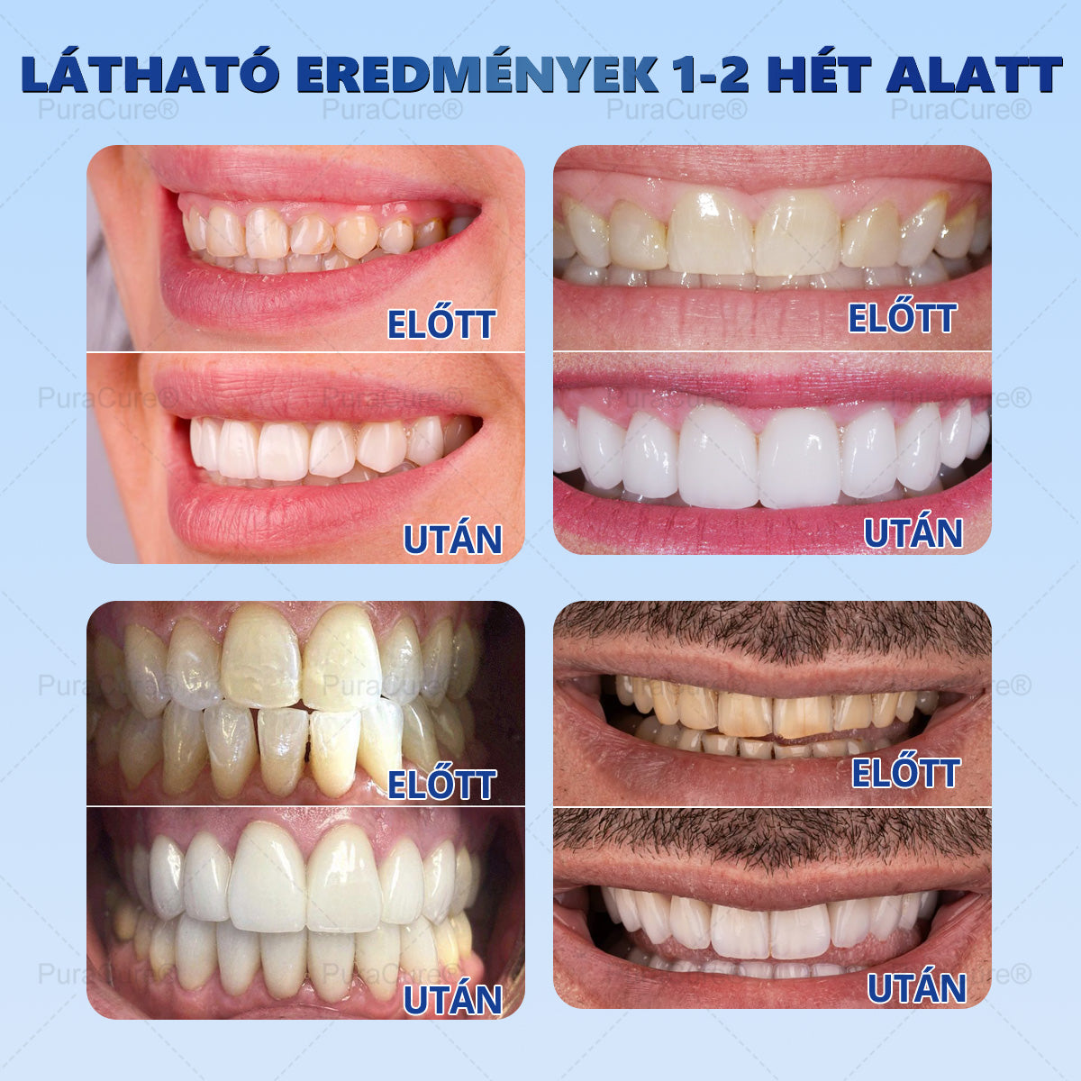 7,5% Nano-Hidroxiapatit Zománcjavító Fogkrém – Fluoridmentes Remineralizáló Formula, Csökkenti a Fogérzékenységet, Segít Megelőzni a Fogszuvasodást, 16 Órás Friss Lehelet – Minden Korosztály Számára