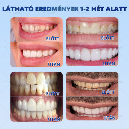 7,5% Nano-Hidroxiapatit Zománcjavító Fogkrém – Fluoridmentes Remineralizáló Formula, Csökkenti a Fogérzékenységet, Segít Megelőzni a Fogszuvasodást, 16 Órás Friss Lehelet – Minden Korosztály Számára