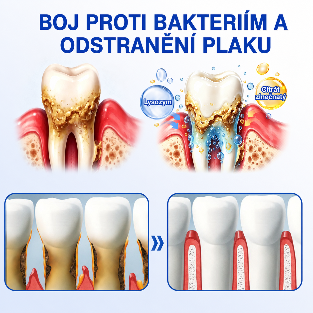 𝐜𝐳) 🦷 𝐏𝐮𝐫𝐚𝐂𝐮𝐫𝐞®  𝐎𝐛𝐧𝐨𝐯𝐚 𝐝á𝐬𝐧í 𝐩𝐚𝐫𝐨𝐝𝐨𝐧𝐭á𝐥𝐧í 𝐨𝐩𝐫𝐚𝐯𝐧ý 𝐠𝐞𝐥