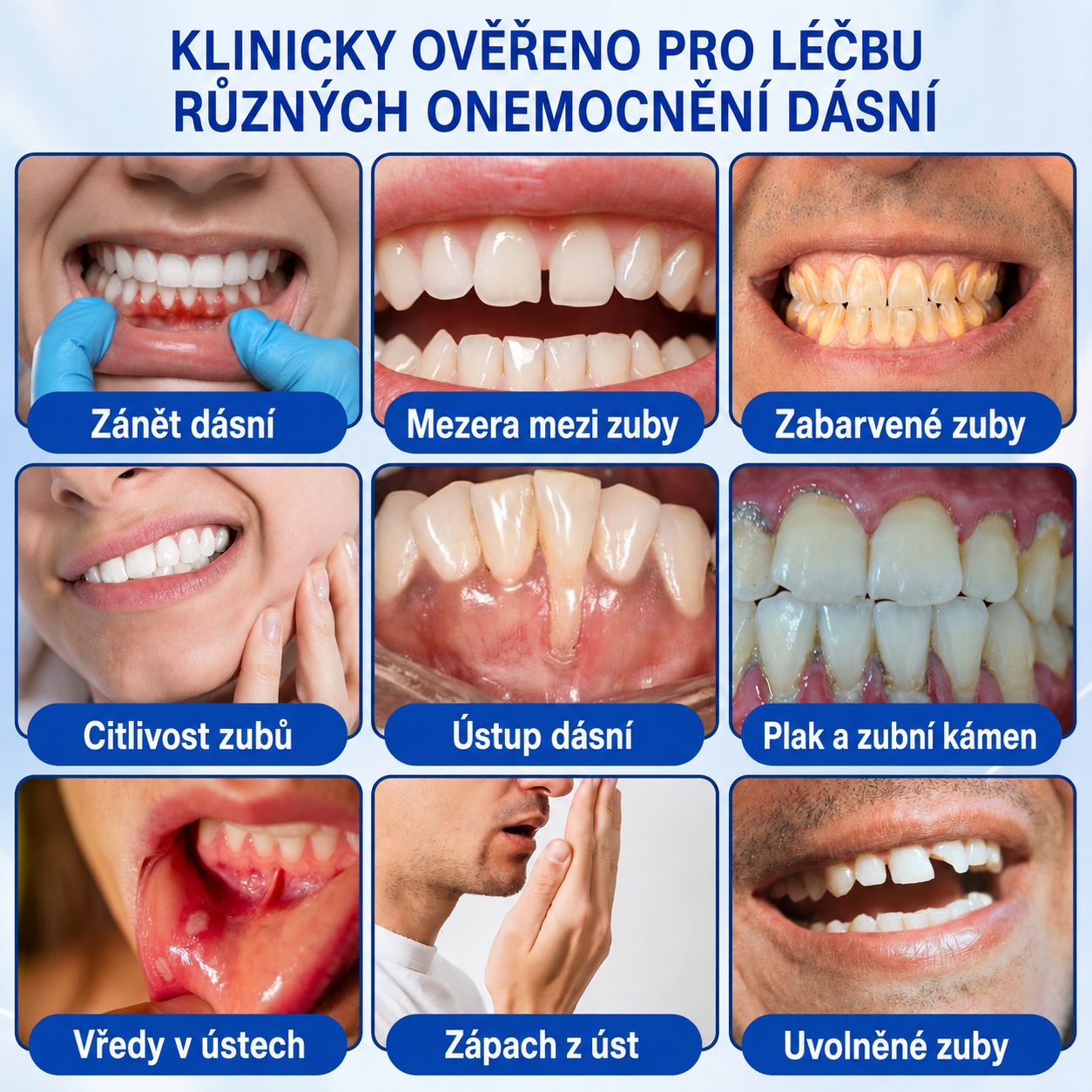 𝐜𝐳) 🦷 𝐏𝐮𝐫𝐚𝐂𝐮𝐫𝐞®  𝐎𝐛𝐧𝐨𝐯𝐚 𝐝á𝐬𝐧í 𝐩𝐚𝐫𝐨𝐝𝐨𝐧𝐭á𝐥𝐧í 𝐨𝐩𝐫𝐚𝐯𝐧ý 𝐠𝐞𝐥